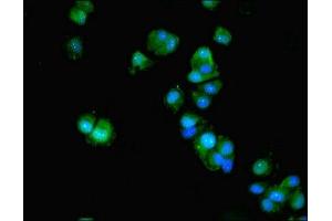 Immunofluorescent analysis of MCF-7 cells using ABIN7143067 at dilution of 1:100 and Alexa Fluor 488-congugated AffiniPure Goat Anti-Rabbit IgG(H+L) (ACTL9 antibody  (AA 1-160))