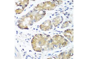 Immunohistochemistry of paraffin-embedded human stomach using NOTCH2 antibody at dilution of 1:100 (40x lens).