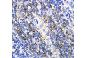 Anti-Annexin VI antibody, IHC(P) IHC(P): Rat Spleen Tissue (ANXA6 antibody  (C-Term))