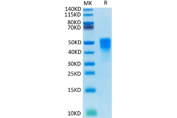 TACSTD2 Protein (His tag)