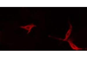 ABIN6279568 staining HepG2 cells by IF/ICC. (Myosin XVI antibody  (Internal Region))