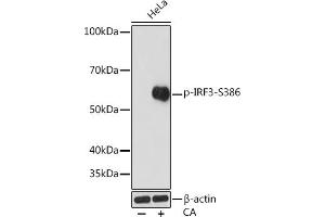 Western blot analysis of extracts of HeLa cells, using Phospho-IRF3-S386 Rabbit mAb (ABIN7267954) at 1:1000 dilution. (IRF3 antibody  (pSer386))