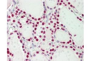 Immunohistochemistry (Paraffin-embedded Sections) (IHC (p)) image for anti-Splicing Factor 3b, Subunit 1, 155kDa (SF3B1) (AA 200-250) antibody (ABIN2628222)
