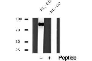 Western blot analysis of extracts of HL-60 cells, using IFT88 antibody.