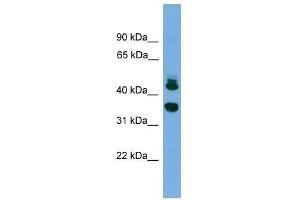 FLJ30934 antibody used at 0. (FLJ30934 (Middle Region) antibody)
