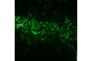 Indirect immunostaining of ribbon synapses in the outer plexiform layer of PFA mouse retina (dilution 1 : 1000). (RIMS2 antibody  (AA 925-1114))