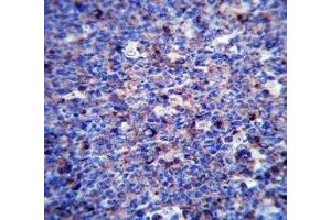 MMP3 antibody immunohistochemistry analysis in formalin fixed and paraffin embedded human tonsil tissue. (MMP3 antibody  (AA 30-59))
