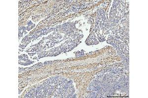 IHC analysis of MT-ND5 using anti-MT-ND5 antibody (ABIN7600145).