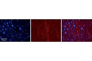 Rabbit Anti-KAT5 Antibody Catalog Number: ARP33345_P050 Formalin Fixed Paraffin Embedded Tissue: Human heart Tissue Observed Staining: Plasma membrane Primary Antibody Concentration: 1:100 Other Working Concentrations: 1:600 Secondary Antibody: Donkey anti-Rabbit-Cy3 Secondary Antibody Concentration: 1:200 Magnification: 20X Exposure Time: 0. (KAT5 antibody  (Middle Region))
