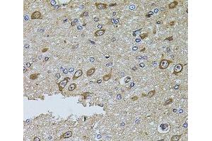 Immunohistochemistry of paraffin-embedded Rat brain using MTIF3 Polyclonal Antibody at dilution of 1:100 (40x lens). (MTIF3 antibody)