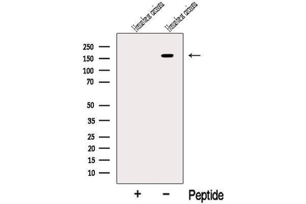 RAB3GAP2 antibody  (Internal Region)