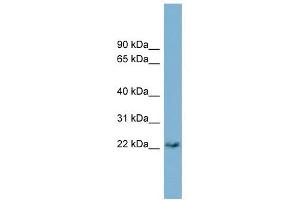 PERP antibody used at 1 ug/ml to detect target protein.