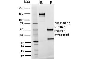 SDS-PAGE Analysis Purified SPASTIN Mouse Monoclonal Antibody (Sp 3G11-1). (Spastin antibody)