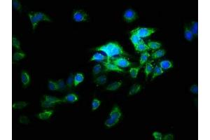 Immunofluorescence staining of HepG2 cells with ABIN7175254 at 1:166, counter-stained with DAPI. (ATP6V1E2 antibody  (AA 1-226))