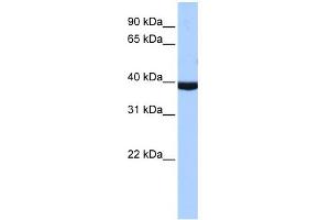 WB Suggested Anti- Antibody Titration:  1. (PAX2A antibody  (Middle Region))