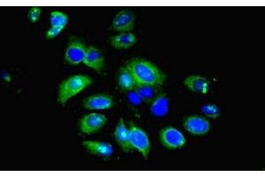 Immunofluorescent analysis of HepG2 cells using ABIN7156675 at dilution of 1:100 and Alexa Fluor 488-congugated AffiniPure Goat Anti-Rabbit IgG(H+L) (IFIT5 antibody  (AA 107-320))