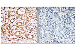 Immunohistochemistry (IHC) image for anti-Ribosomal Protein S19 (RPS19) (Internal Region) antibody (ABIN1850576)