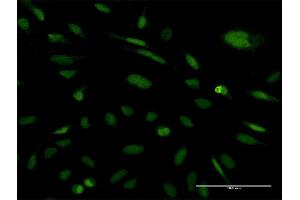 Immunofluorescence of monoclonal antibody to EXOSC5 on HeLa cell. (EXOSC5 antibody  (AA 1-235))