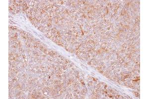 IHC-P Image Immunohistochemical analysis of paraffin-embedded DLD-1 xenograft, using TMED9, antibody at 1:500 dilution. (TMED9 antibody  (Center))
