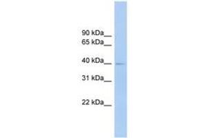 Image no. 1 for anti-Fc Receptor-Like A (FCRLA) (AA 287-336) antibody (ABIN6744875) (FCRLA antibody  (AA 287-336))