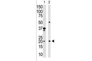 Image no. 1 for anti-Hippocalcin (HPCA) (N-Term) antibody (ABIN357112) (Hippocalcin antibody  (N-Term))