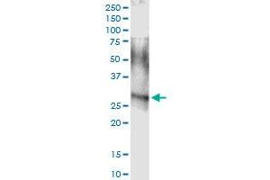 Immunoprecipitation of ARHGDIA transfected lysate using anti-ARHGDIA MaxPab rabbit polyclonal antibody and Protein A Magnetic Bead , and immunoblotted with ARHGDIA MaxPab mouse polyclonal antibody (B01) . (ARHGDIA antibody  (AA 1-204))