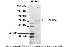 Lanes:   Lane1: HIS-HCFC1 16-363aa (42kD) transformed bacteria lysate Lane2: GFP-HCFC1 363-2002aa (73kD) transformed bacteria lysate elution sample  Primary Antibody Dilution:   1:1000  Secondary Antibody:   Anti-rabbit AlexaFluor 680  Secondary Antibody Dilution:   1:10000  Gene Name:   HCFC1  Submitted by:   Anonymous (HCFC1 antibody  (N-Term))