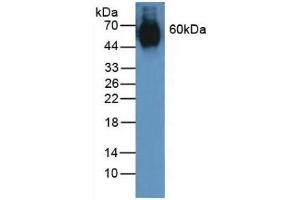 Detection of ELN in Human Lung Tissue using Polyclonal Antibody to Elastin (ELN) (Elastin antibody  (AA 392-645))