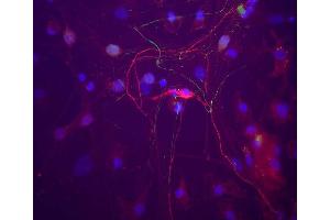 A neuron in a rat cortical neuron culture which stains strongly for peripherin with ABIN1580457 (red). (Peripherin antibody)
