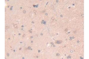IHC-P analysis of Rat Spinal cord Tissue, with DAB staining. (LAMB2 antibody  (AA 75-223))