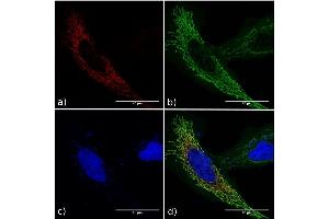 Immunofluorescence staining of fixed HeLa cells expressing mCherry tagged GCN4 with anti-GCN4 antibody C11L34. (Recombinant GCN4 antibody)