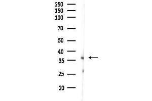anti-Retina and Anterior Neural Fold Homeobox (RAX) antibody