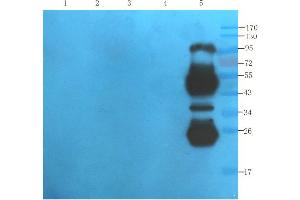 Western Blot using anti-IL2R antibody   Mouse lipocyte (lane 1), mouse spleen (lane 2), mouse thymus (lane 3), mouse lymph node (lane 4) and human thyroid tumour (lane 5) samples were resolved on a 10% SDS PAGE gel and blots probed with  at 1. (Recombinant IL2RA (Daclizumab Biosimilar) antibody)