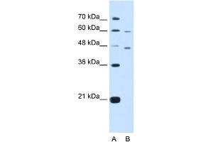 WB Suggested Anti-CRELD1 Antibody Titration:  5. (CRELD1 antibody  (C-Term))