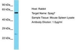 Image no. 1 for anti-Sperm Associated Antigen 7 (SPAG7) (N-Term) antibody (ABIN6750536) (SPAG7 antibody  (N-Term))