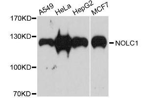 Western blot analysis of extracts of various cell lines, using NOLC1 antibody. (NOLC1 antibody  (AA 400-699))