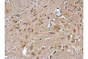 IHC-P Image GLMN antibody detects GLMN protein at cytosol on mouse fore brain by immunohistochemical analysis. (GLMN antibody)