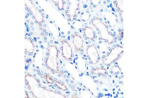 Immunohistochemistry (IHC) image for anti-Lysosomal-Associated Membrane Protein 2 (LAMP2) antibody (ABIN7268345)