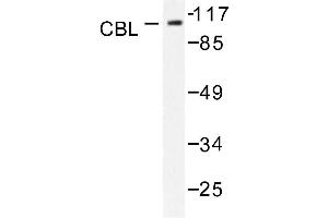 Image no. 1 for anti-Cas-Br-M (Murine) Ecotropic Retroviral Transforming Sequence (CBL) antibody (ABIN271925) (CBL antibody)