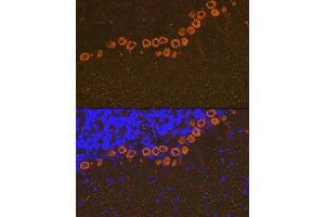 Immunofluorescence analysis of mouse brain using IP3R Rabbit mAb (ABIN1679064, ABIN3018927, ABIN3018928 and ABIN7101690) at dilution of 1:100 (40x lens). (ITPR1 antibody)