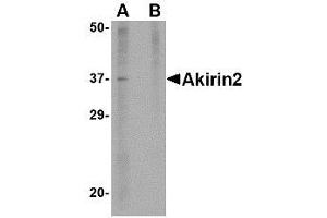 Image no. 1 for anti-Akirin 2 (AKIRIN2) (Internal Region) antibody (ABIN342720)