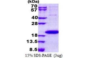 SDS-PAGE (SDS) image for Interleukin 1 Family Member 9 (IL1F9) (AA 1-169) protein (His tag) (ABIN5853123)