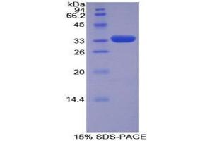 SDS-PAGE (SDS) image for TNF Receptor-Associated Factor 5 (TRAF5) (AA 181-437) protein (His tag) (ABIN1877579)