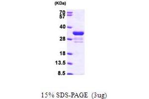 SDS-PAGE (SDS) image for Cell Cycle Checkpoint Protein RAD1 (RAD1) (AA 1-282) protein (His tag) (ABIN7279094)