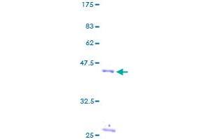 RPS17 Protein (AA 1-135) (GST tag)