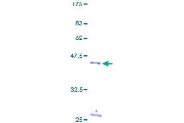 RPS17 Protein (AA 1-135) (GST tag)