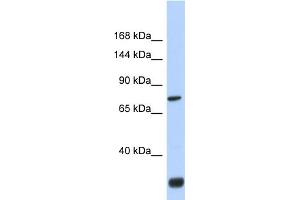 Host:  Rabbit  Target Name:  FNDC3A  Sample Type:  Fetal Brain lysates  Antibody Dilution:  1. (FNDC3A antibody  (N-Term))