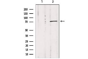 Western blot analysis of extracts from Mouse Myeloma cell, using MPP5 antibody. (MPP5 antibody  (C-Term))