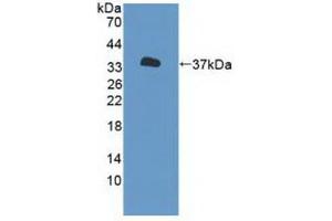 Western blot analysis of recombinant Human P2RX7. (P2RX7 antibody  (AA 47-334))