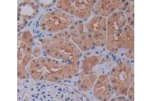 Used in DAB staining on fromalin fixed paraffin- embedded kidney tissue